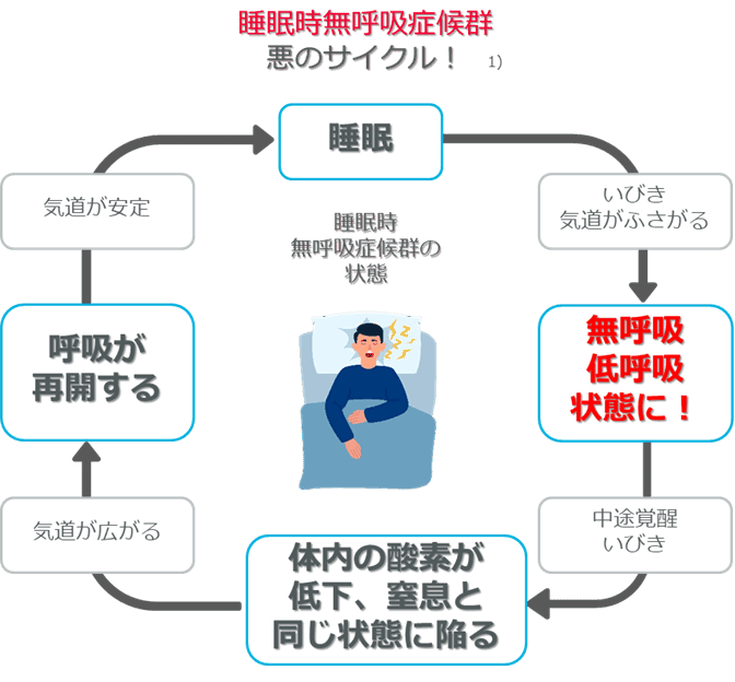 睡眠時無呼吸症候群とは?